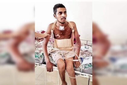 Falling from overcrowded delayed train, Titwala resident almost on death bed begins to walk again | Mumbai News