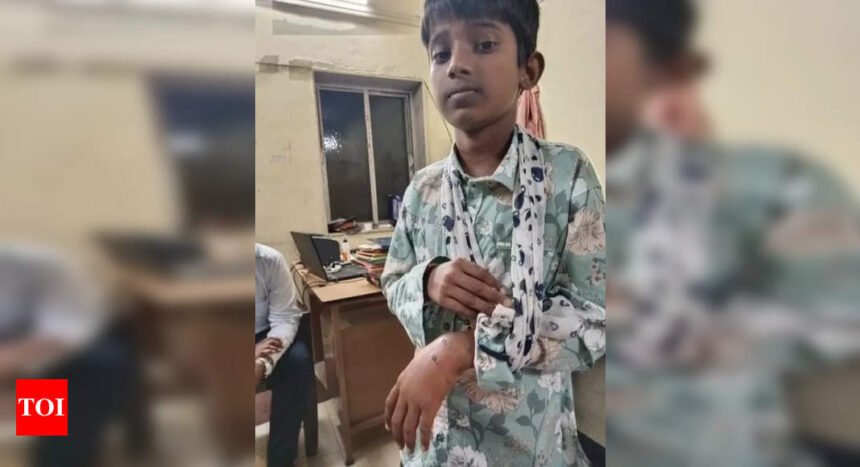 Pet German Shepherd attacks 12-yr-old boy in G’kopar, FIR on owner | Mumbai News