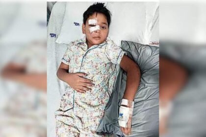 Plastic surgery on 8-yr-old boy after dog bite | Mumbai News