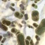 Exploring the link between newborn gut bacteria and food allergies: Insights from a Japanese study | Mumbai News