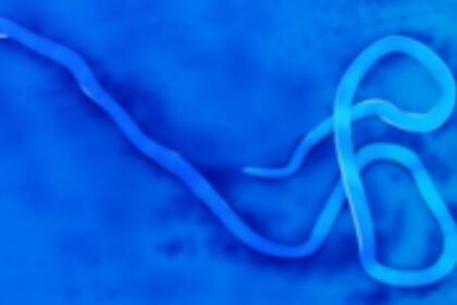 Hospital nurse dies in Uganda in first Ebola virus outbreak since 2022, health ministry says